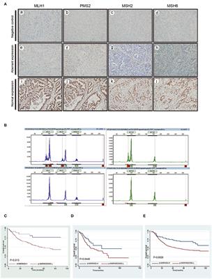 The Better Survival of MSI Subtype Is Associated With the Oxidative Stress Related Pathways in Gastric Cancer